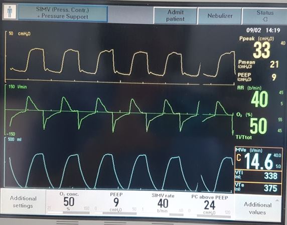Prone Positioning in Severe Acute Respiratory Distress Syndrome ...