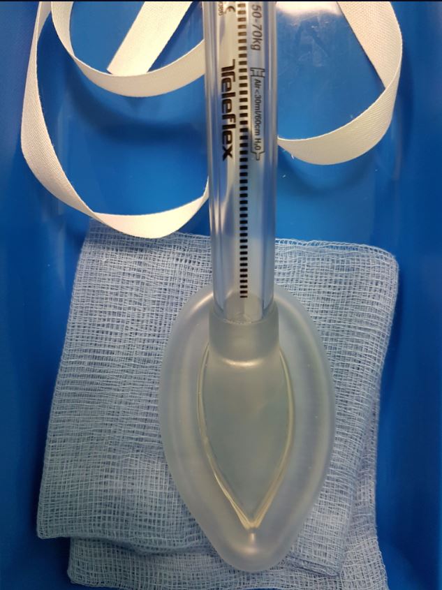 Deep or Awake Removal of Laryngeal Mask Airway in Children at Risk of Respiratory Adverse Events