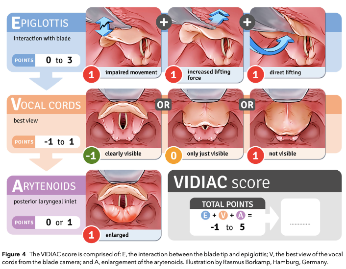 vidiac-score