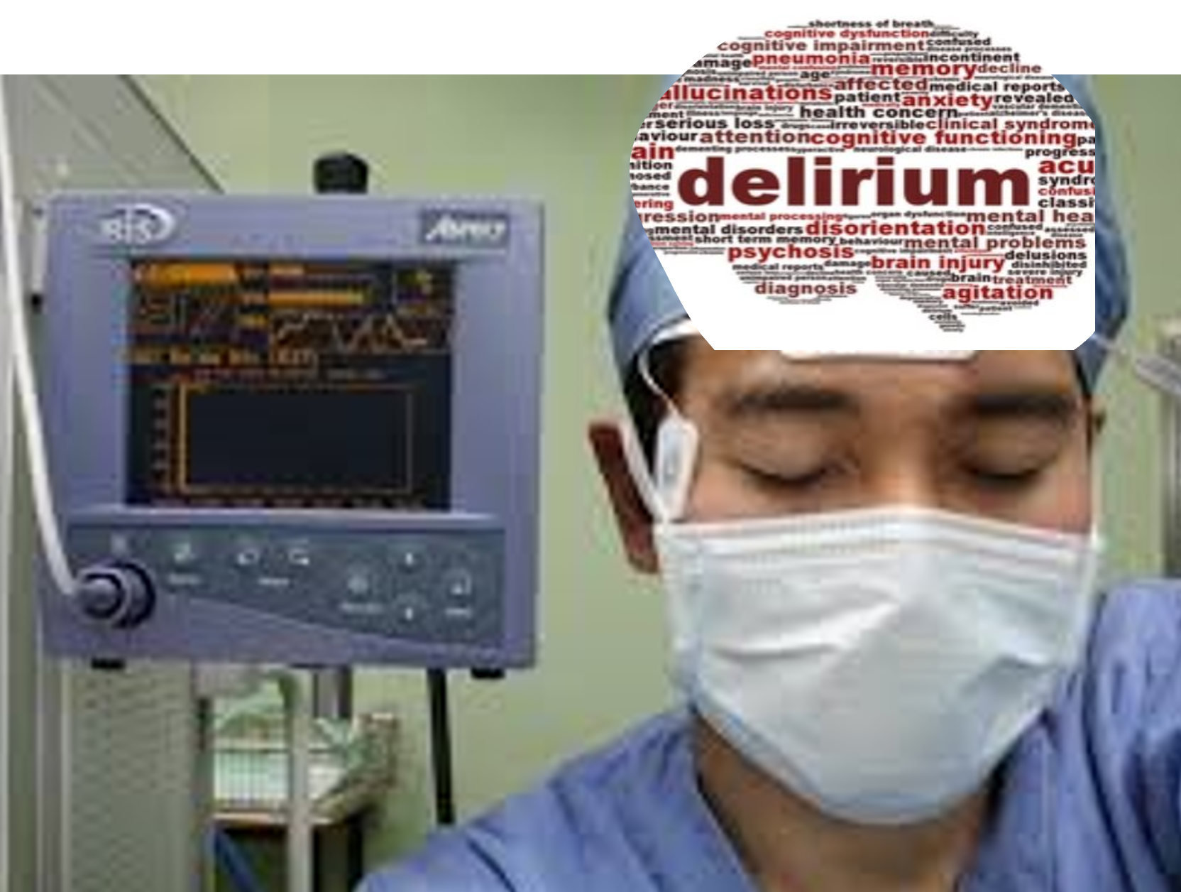 Anaesthetic Depth and Delirium After Major Surgery – A Randomised ...